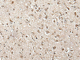 ZFP36 Polyclonal Antibody Reactivity Human