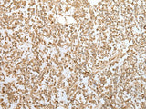 ZKSCAN1 Polyclonal Antibody Reactivity Human