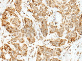 ZKSCAN1 Polyclonal Antibody Reactivity Human