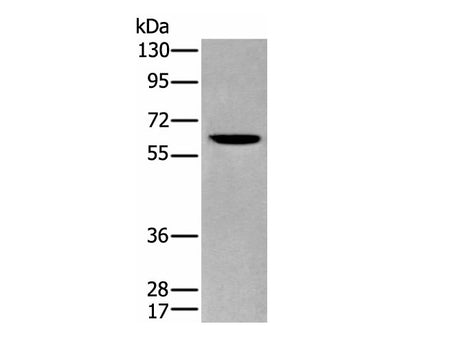 ZKSCAN1 Polyclonal Antibody Reactivity Human