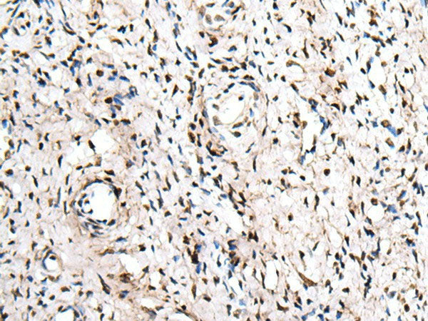 ZNF207 Polyclonal Antibody Reactivity Human