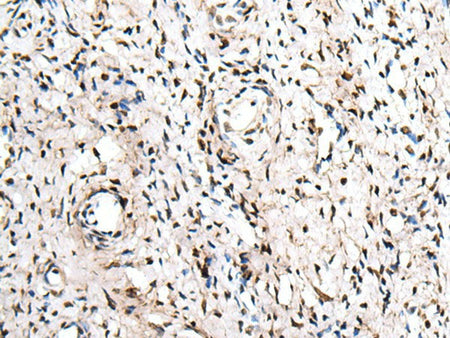 ZNF207 Polyclonal Antibody Reactivity Human