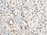 ZNF207 Polyclonal Antibody Reactivity Human