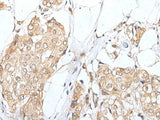 ZNF263 Polyclonal Antibody Reactivity Human
