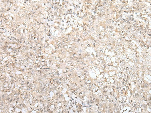 ZNF263 Polyclonal Antibody Reactivity Human