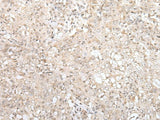 ZNF263 Polyclonal Antibody Reactivity Human