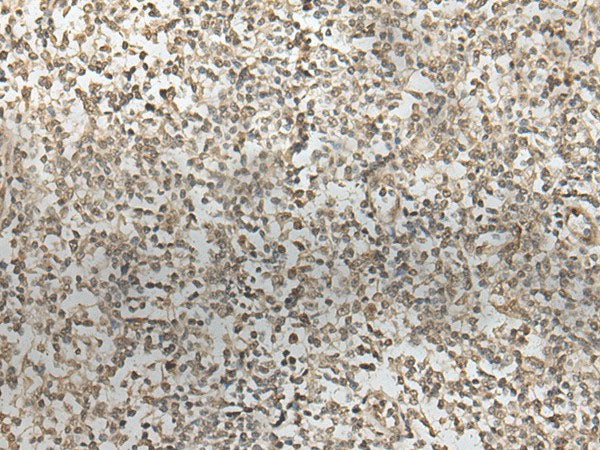 ZNF274 Polyclonal Antibody