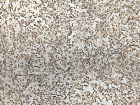 ZNF274 Polyclonal Antibody