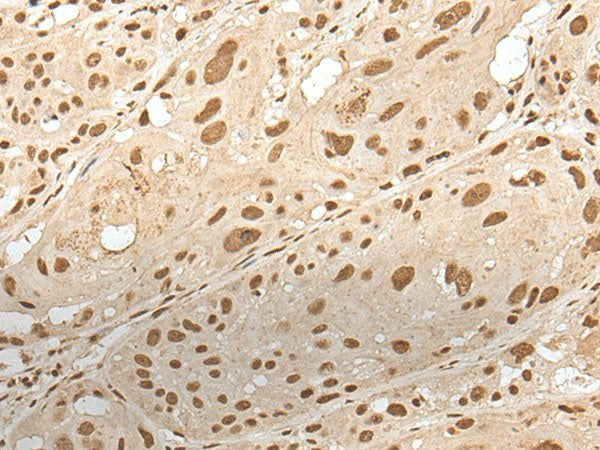 ZNF274 Polyclonal Antibody