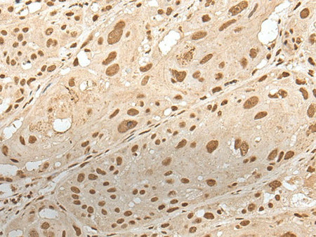 ZNF274 Polyclonal Antibody