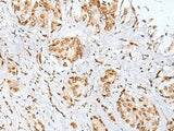 ZNF354A Polyclonal Antibody Reactivity Human
