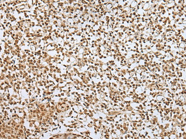 ZNF354A Polyclonal Antibody Reactivity Human