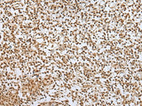 ZNF354A Polyclonal Antibody Reactivity Human