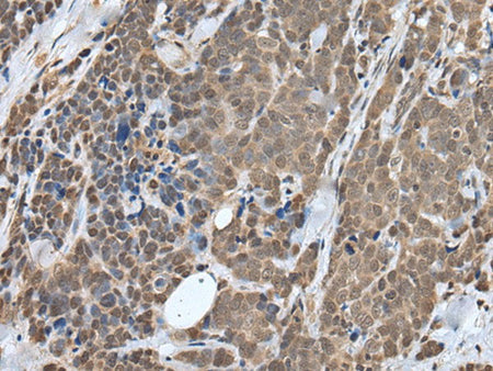 ZNF410 Polyclonal Antibody