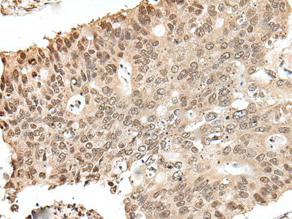 ZNF410 Polyclonal Antibody