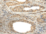 ZNF8 Polyclonal Antibody
