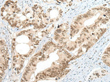 ZNF83 Polyclonal Antibody