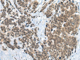 ZNF83 Polyclonal Antibody