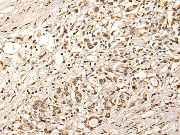 ZSCAN12 Polyclonal Antibody Reactivity Human