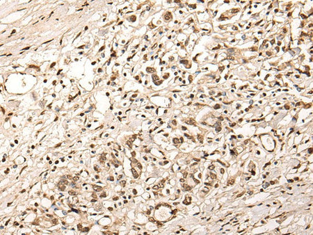 ZSCAN12 Polyclonal Antibody Reactivity Human