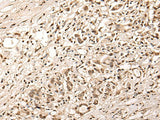 ZSCAN12 Polyclonal Antibody Reactivity Human