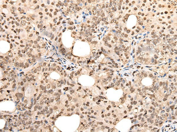 ZSCAN12 Polyclonal Antibody Reactivity Human