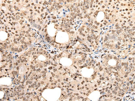 ZSCAN12 Polyclonal Antibody Reactivity Human