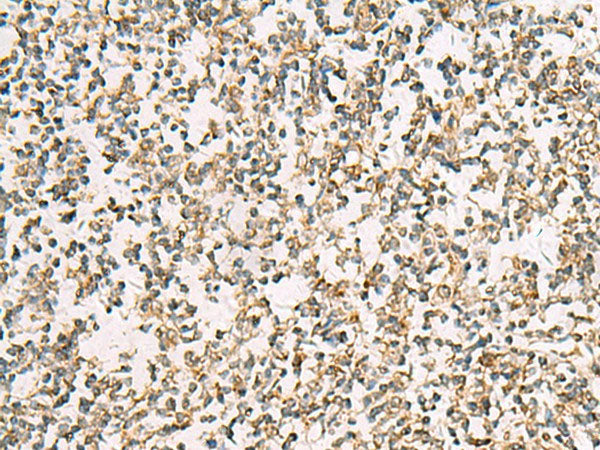 ZPBP2 Polyclonal Antibody Reactivity Human