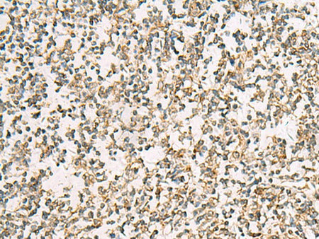 ZPBP2 Polyclonal Antibody Reactivity Human