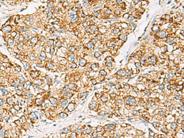 ZPBP2 Polyclonal Antibody Reactivity Human