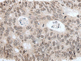 HIST1H3A Polyclonal Antibody Reactivity Mouse