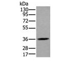 ACAT2 Polyclonal Antibody Reactivity Human