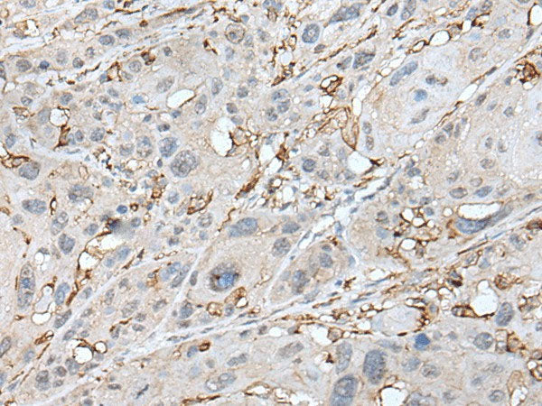 CD14 Polyclonal Antibody Reactivity Human