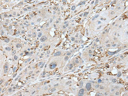 CD14 Polyclonal Antibody Reactivity Human