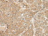 TDGF1 Polyclonal Antibody Reactivity Human
