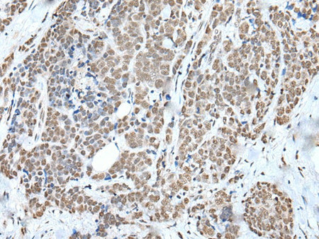 WTAP Polyclonal Antibody Reactivity Human