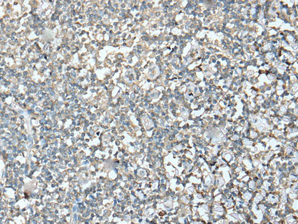 VASP Polyclonal Antibody Reactivity Human