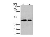VASP Polyclonal Antibody Reactivity Human