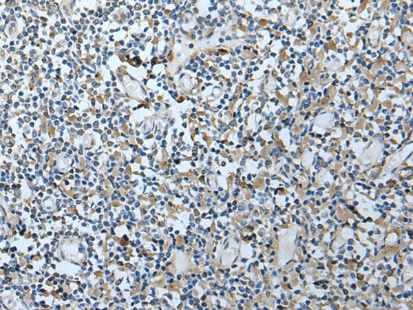 VDAC1 Polyclonal Antibody Reactivity Human