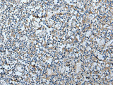 VDAC1 Polyclonal Antibody Reactivity Human