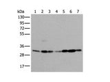 VDAC1 Polyclonal Antibody Reactivity Human