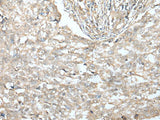VILL Polyclonal Antibody Reactivity Human