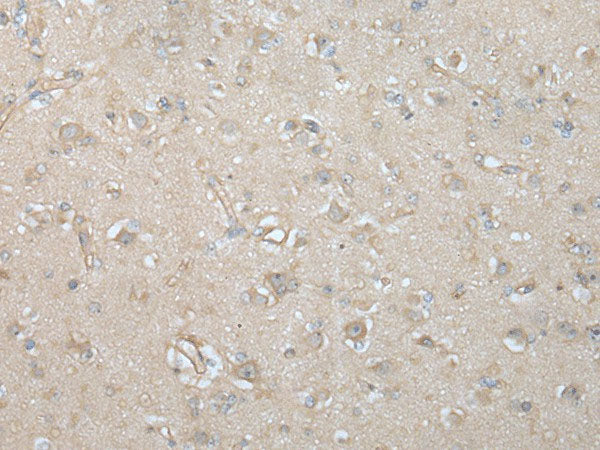 VILL Polyclonal Antibody Reactivity Human