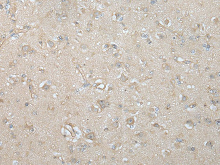 VILL Polyclonal Antibody Reactivity Human
