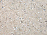 VILL Polyclonal Antibody Reactivity Human