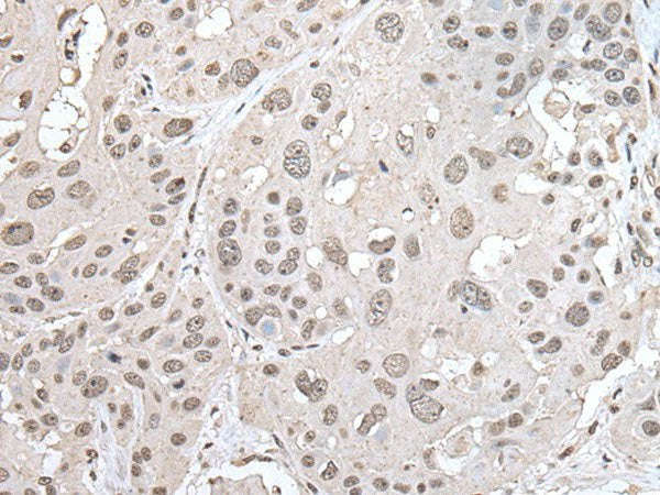 VRK1 Polyclonal Antibody