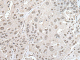 VRK1 Polyclonal Antibody