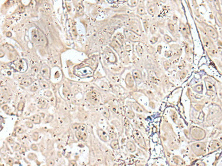 VRK3 Polyclonal Antibody