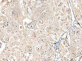 VRK3 Polyclonal Antibody