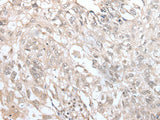 VRK3 Polyclonal Antibody